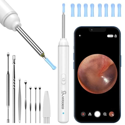 Limitiertes Angebot: Ohrenschmalz Entferner Otoskop, VITCOCO 1920P Wifi Ohrreiniger, Ohrenreiniger mit Kamera, Otoskop mit 6 LEDs für iPhone, iPad und Android-Smartphones, Weiß von 24.99 EUR auf 14.72 EUR (Spare 41%)