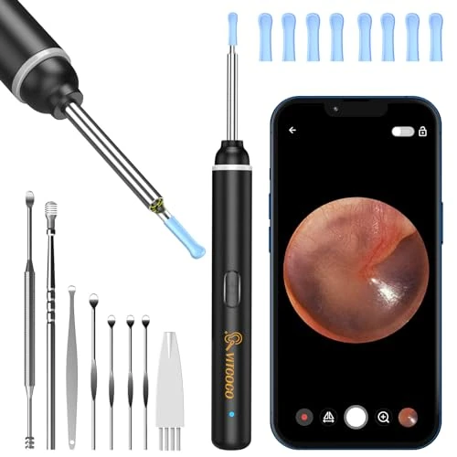 Offre limitee: VITCOCO Otoscope Oreille, Nettoyage Oreille avec Camera 1920P Wifi, Cure Oreille Camera Étanchéité IP67 avec 6 Led, Kit de Otoscope 8 Accessoires aux IOS et Android (Noir) de 19.99 EUR a 19.99 EUR (economie 0%)