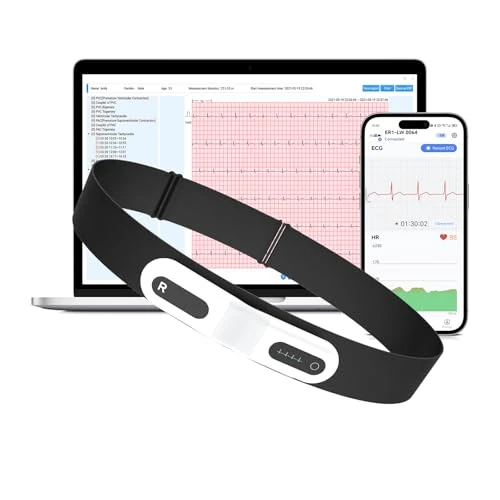 Offerta a tempo: CheckMe ER1-LW Monitor ECG Portatile per 72 Ore con Analisi ECG AI,Holter ECG monitor con Schermo OLED,Funzione Marcatore Evento ECG,App e PC-software,Compatibile con Elettrodi a scatto da 4 mm - 0.00% da 359.99 € a 359.99 €