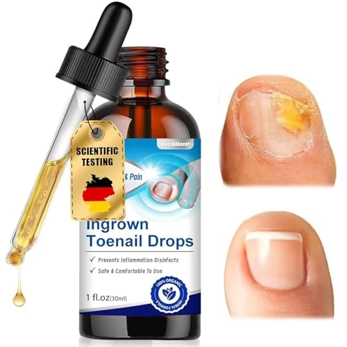 30 ml Cuidado profesional Pie, Reparadoras purificantes Uñas Dañadas, Pueden Calmar y Nutrir Las Uñas, Fácil y rápido