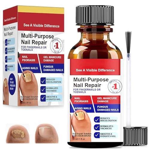 Offerta a tempo: Lozione Riparatrice Per Unghie, Siero Per La Cura Delle Unghie, 30ML - 55% da 19.99 € a 8.99 €