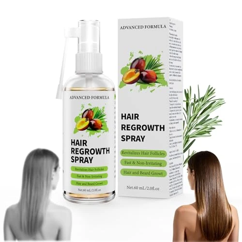 Offerta a tempo: VIVEY Siero Crescita Capelli Olio Di Ricino e Rosmarino/Biotina Donna Uomo - 38% da 19.99 € a 12.44 €