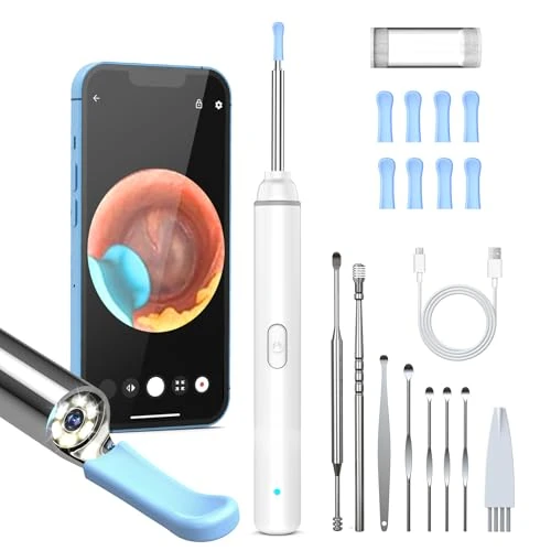 Offerta a tempo: Pulizia Orecchie Otoscopio, 1920P HD P con 6 LED, 3.5mm Pulitore Orecchie - 0.00% da 24.99 € a 24.99 €