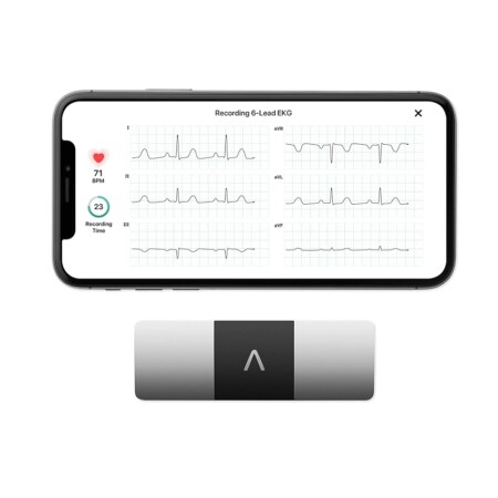 offerta a tempo: alivecor kardiamobile 6l ecg di livello medico | l’ecg portatile a 6 derivazioni | — 15% da 189,00 € a 159,99 €
